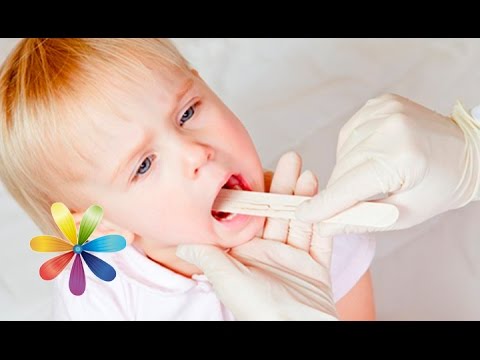 Treatment of tonsillitis in children at home