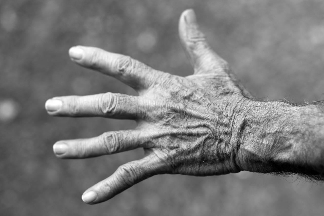 Comment traiter l'eczéma sur les mains